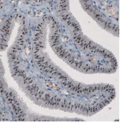 Immunohistochemistry: NOP56 Antibody (CL2603) [NBP2-36778] - Staining of human fallopian tube shows strong nucleolar immunoreactivity in glandular and connective tissue cell