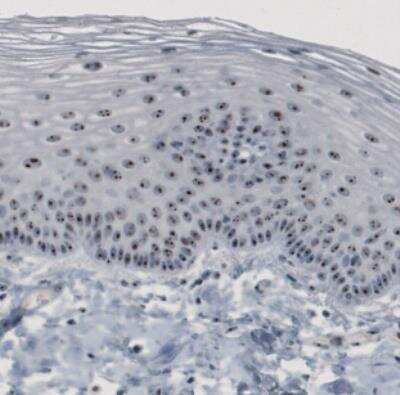 Immunohistochemistry: NOP56 Antibody (CL2603) [NBP2-36778] - Staining of human cervix shows strong nucleolar immunoreactivity in the epithelial cells.