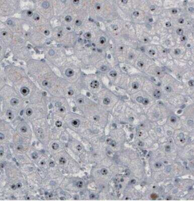 Immunohistochemistry: NOP56 Antibody (CL2603) [NBP2-36778] - Staining of human liver shows strong nucleolar positivity in hepatocytes.