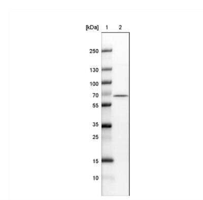 Western Blot: NOP56 Antibody (CL2603) [NBP2-36778] - Lane 1: Marker  [kDa].  Lane 2:Human cell line U-251 MG