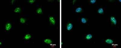 Immunocytochemistry/Immunofluorescence: NOP56 Antibody [NBP3-12977] - NOP56 antibody detects NOP56 protein at nucleolus and nucleus by immunofluorescent analysis. Sample: HeLa cells were fixed in 4% paraformaldehyde at RT for 15 min. Green: NOP56 protein stained by NOP56 antibody (NBP3-12977) diluted at 1:500. Blue: Hoechst 33342 staining. Scale bar = 10 um.