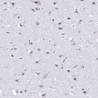 Immunohistochemistry-Paraffin: NOP56 Antibody [NBP2-13666] - Staining of human cerebral cortex shows strong positivity in nucleoli in neurons.