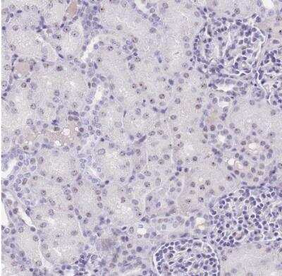 Immunohistochemistry-Paraffin: NOP56 Antibody [NBP2-13666] - Human kidney shows weak positivity in nucleoli in cells in tubules.