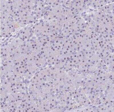 Immunohistochemistry-Paraffin: NOP56 Antibody [NBP2-13666] - Human pancreas shows weak postivity in nucleoli in exocrine glandular cells.