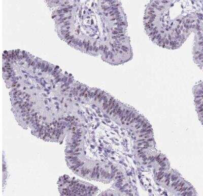 Immunohistochemistry-Paraffin: NOP56 Antibody [NBP2-13666] - Staining of human fallopian tube shows moderate postivity in nucleoli in glandular cells.