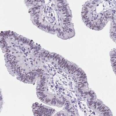 Immunohistochemistry-Paraffin: NOP56 Antibody [NBP2-13666] - Staining of human fallopian tube shows moderate positivity in nucleoli in glandular cells.