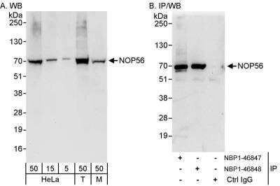 Western Blot: NOP56 Antibody [NBP1-46847] - Samples:  Whole cell lysate from HeLa (5, 15 and 50 ug for WB; 1 mg for IP, 20% of IP loaded), 293T (T; 50 ug), and mouse NIH3T3 (M; 50 ug) cells.  Antibodies: Affinity purified rabbit anti-NOP56 antibody NBP1-46847 used for WB at 0.04 ug/ml (A) and 1 ug/ml (B) and used for IP at 3 ug/mg lysate.  NOP56 was also immunoprecipitated by rabbit anti-NOP56 antibody NBP1-46848, which recognizes a downstream epitope.  Detection: Chemiluminescence with exposure times of 30 seconds (A) and 10 seconds (B).