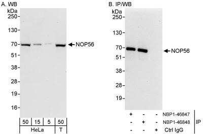 Western Blot: NOP56 Antibody [NBP1-46848] - Samples:  Whole cell lysate from HeLa (5, 15 and 50 ug for WB; 1 mg for IP, 20% of IP loaded) and 293T (T; 50 ug) cells.  Antibodies: Affinity purified rabbit anti-NOP56 antibody NBP1-46848 used for WB at 0.04 ug/ml (A) and 1 ug/ml (B) and used for IP at 3 ug/mg lysate.  NOP56 was also immunoprecipitated by rabbit anti-NOP56 antibody NBP1-46847, which recognizes an upstream epitope.  Detection: Chemiluminescence with exposure times of 30 seconds (A) and 10 seconds (B).