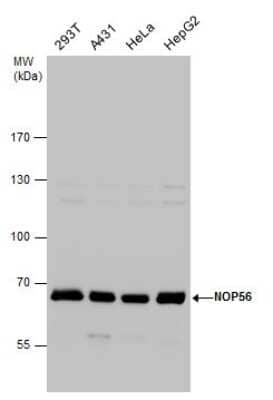 Western Blot: NOP56 Antibody [NBP3-12977] - NOP56 antibody detects NOP56 protein by western blot analysis. Various whole cell extracts (30 ug) were separated by 7.5% SDS-PAGE, and the membrane was blotted with NOP56 antibody (NBP3-12977) diluted at a dilution of 1:1000.