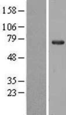 Western Blot: NOP56 Overexpression Lysate (Adult Normal) [NBL1-13711] - Western Blot experiments.  Left-Control; Right -Over-expression Lysate for NOP56