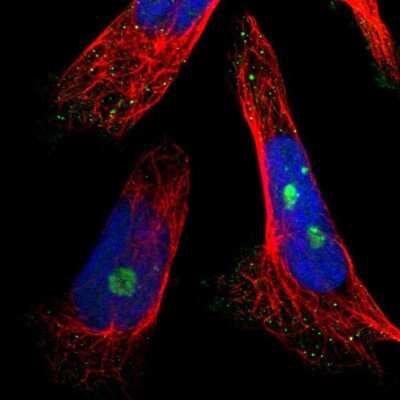 <b>Independent Antibodies Validation. </b>Immunocytochemistry/Immunofluorescence: NOP58 Antibody [NBP1-81680] - Staining of human cell line U-251 MG shows localization to nucleoli fibrillar center. Antibody staining is shown in green.