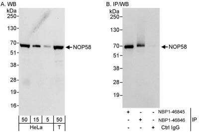 Immunoprecipitation: NOP58 Antibody [NBP1-46846] - Samples:  Whole cell lysate from HeLa (5, 15 and 50 ug for WB; 1 mg for IP, 20% of IP loaded) and 293T (T; 50 ug) cells.  Antibodies: Affinity purified rabbit anti-NOP58 antibody NBP1-46846 used for WB at 0.04 ug/ml (A) and 0.4 ug/ml (B) and used for IP at 3 ug/mg lysate.  NOP58 was also immunoprecipitated by rabbit anti-NOP58 antibody NBP1-46845, which recognizes an upstream epitope.  Detection: Chemiluminescence with exposure times of 10 seconds (A) and 3 seconds (B).