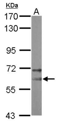 Western Blot: NOP58 Antibody [NBP2-19564] - Sample (50 ug of whole cell lysate) A: Mouse Brain, 7. 5% SDS PAGE gel, diluted at 1:10000.