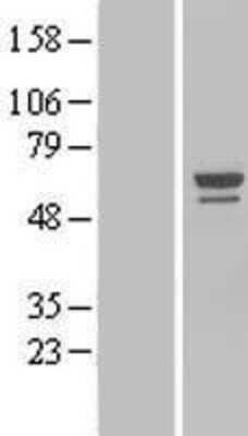 Western Blot: NOP58 Overexpression Lysate (Adult Normal) [NBL1-13718] Left-Empty vector transfected control cell lysate (HEK293 cell lysate); Right -Over-expression Lysate for NOP58.