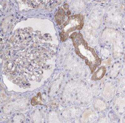 Immunohistochemistry-Paraffin: NOS1AP Antibody [NBP2-38151] - Staining of human kidney shows moderate cytoplasmic positivity in cells in distal tubules.