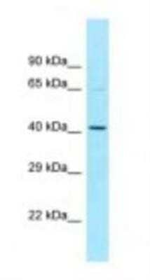 Western Blot: NOS1AP Antibody [NBP1-98487] - Hela Cell Lysate 1.0ug/ml, Gel Concentration: 12%