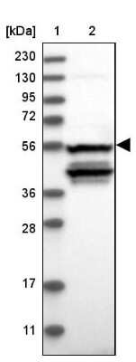 Western Blot: NOS1AP Antibody [NBP2-38151] - Lane 1: Marker  [kDa] 230, 130, 95, 72, 56, 36, 28, 17, 11.  Lane 2: Human cell line RT-4