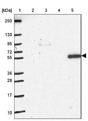 Western Blot: NOS1AP Antibody [NBP2-38758] - Lane 1: Marker  [kDa] 250, 130, 95, 72, 55, 36, 28, 17, 10.  Lane 2: Human cell line RT-4.  Lane 3: Human cell line U-251MG.  Lane 4: Human Plasma.  Lane 5: Human liver tissue