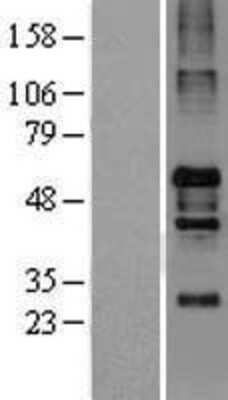 Western Blot: NOS1AP Overexpression Lysate (Adult Normal) [NBL1-13720] Left-Empty vector transfected control cell lysate (HEK293 cell lysate); Right -Over-expression Lysate for NOS1AP.