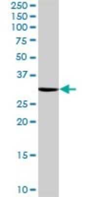 Western Blot: NOSIP Antibody [H00051070-B01P] - Analysis of NOSIP expression in Jurkat.