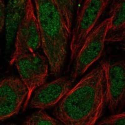 Immunocytochemistry/Immunofluorescence: NOTO Antibody [NBP3-17523] - Staining of human cell line SiHa shows localization to nucleoplasm.