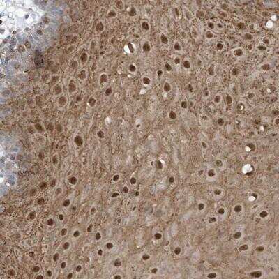 Immunohistochemistry-Paraffin: NOTO Antibody [NBP1-91009] - Staining of human oral mucosa shows moderate nuclear and cytoplasmic positivity in squamous epithelial cells.