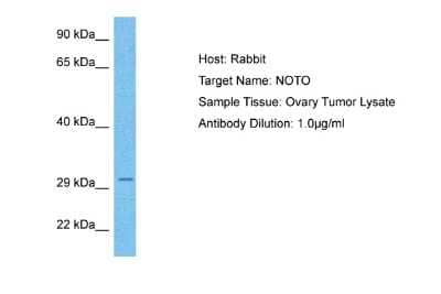 Western Blot: NOTO Antibody [NBP2-83288] - Host: Rabbit. Target Name: NOTO. Sample Type: Ovary Tumor lysates. Antibody Dilution: 1.0ug/ml