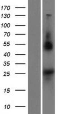 Western Blot: NOTO Overexpression Lysate (Adult Normal) [NBP2-09547] Left-Empty vector transfected control cell lysate (HEK293 cell lysate); Right -Over-expression Lysate for NOTO.