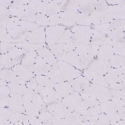 Immunohistochemistry-Paraffin: NOV/CCN3 Antibody [NBP1-88154] - Staining of human skeletal muscle shows no positivity in myocytes as expected.