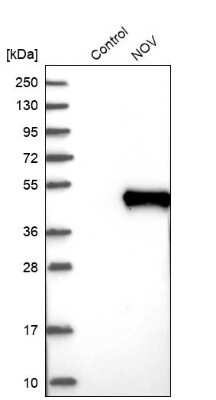 <b>Orthogonal Strategies Validation. </b>Western Blot: NOV/CCN3 Antibody [NBP1-88154] - Analysis in control (vector only transfected HEK293T lysate) and NOV over-expression lysate (Co-expressed with a C-terminal myc-DDK tag (3.1 kDa) in mammalian HEK293T cells).