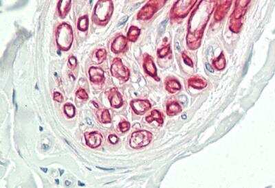 Immunohistochemistry-Paraffin: NOX3 Antibody [NBP2-84190] - Rabbit Anti-NOX3 antibody. Formalin Fixed Paraffin Embedded Tissue: Human Peripheral Nerve. Primary antibody Concentration: 1:100. Secondary Antibody: Donkey anti-Rabbit-Cy3. Secondary Antibody Concentration: 1:200. Magnification: 20x. Exposure Time: 0.5-2.0sec