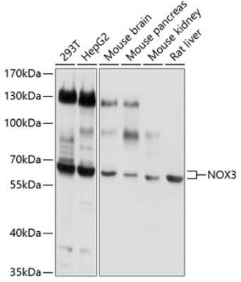 Western Blot: NOX3 Antibody [NBP2-94866] - Analysis of extracts of various cell lines, using NOX3 at 1:1000 dilution.Secondary antibody: HRP Goat Anti-Rabbit IgG (H+L) at 1:10000 dilution.Lysates/proteins: 25ug per lane.Blocking buffer: 3% nonfat dry milk in TBST.Detection: ECL Basic Kit .Exposure time: 30s.