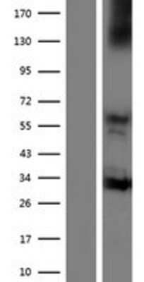 Western Blot: NOX3 Overexpression Lysate (Adult Normal) [NBP2-07120] Left-Empty vector transfected control cell lysate (HEK293 cell lysate); Right -Over-expression Lysate for NOX3.