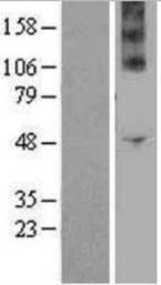 Western Blot: NOX4 Overexpression Lysate (Adult Normal) [NBP2-04362] - Left - Empty vector transfection control lysate (HEKP293 cell lysate); Right - NOX4 Over-expression Lysate,