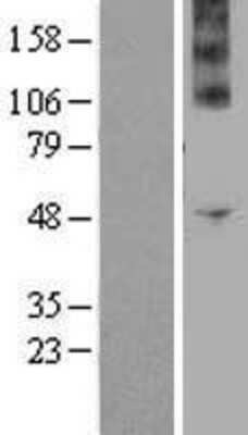 Western Blot: NOX4 Overexpression Lysate (Adult Normal) [NBP2-04362] Left-Empty vector transfected control cell lysate (HEK293 cell lysate); Right -Over-expression Lysate for NOX4.