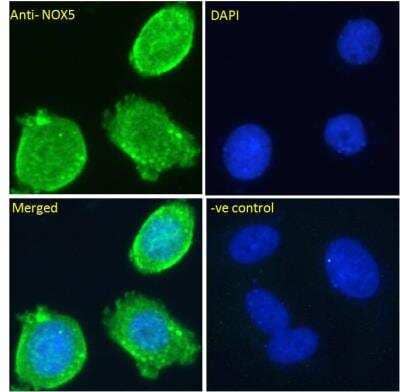 Immunocytochemistry/Immunofluorescence: NOX5 Antibody [NBP1-68862] - Analysis of paraformaldehyde fixed MCF7 cells, permeabilized with 0.15% Triton. Primary incubation 1hr (10ug/ml) followed by Alexa Fluor 488 secondary antibody (2ug/ml), showing staining within the cytoplasm and plasma membrane . The nuclear stain is DAPI (blue).Negative control: Unimmunized goat IgG (10ug/ml) followed by Alexa Fluor 488 secondary antibody (2ug/ml).