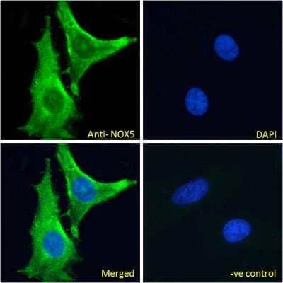 Immunocytochemistry/Immunofluorescence: NOX5 Antibody [NBP1-68862] - Analysis of paraformaldehyde fixed HeLa cells, permeabilized with 0.15% Triton. Primary incubation 1hr (10ug/ml) followed by Alexa Fluor 488 secondary antibody (2ug/ml), showing staining within the cytoplasm and plasma membrane . The nuclear stain is DAPI (blue). Negative control: Unimmunized goat IgG (10ug/ml) followed by Alexa Fluor 488 secondary antibody (2ug/ml).
