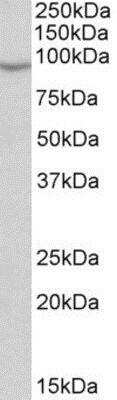Western Blot NOX5 Antibody
