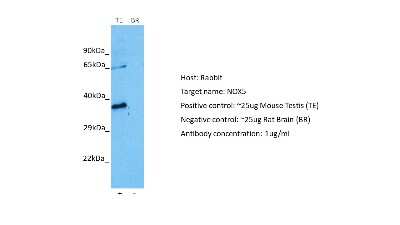 Western Blot: NOX5 Antibody [NBP2-84191] - Host: Rabbit. Target: NOX5. Positive control (+): Mouse Testis (M-TE). Negative control (-): Rat Brain (R-BR). Antibody concentration: 1ug/ml