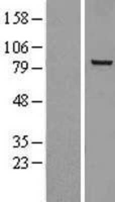 Western Blot: NOX5 Overexpression Lysate (Adult Normal) [NBL1-13733] Left-Empty vector transfected control cell lysate (HEK293 cell lysate); Right -Over-expression Lysate for NOX5.