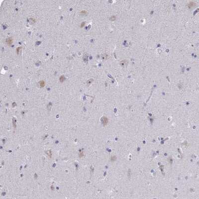Immunohistochemistry-Paraffin NOXRED1 Antibody - BSA Free