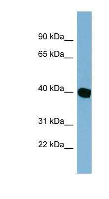 Western Blot: NOXRED1 Antibody [NBP1-70434] - NOXRED1 Antibody HT1080 cell lysate, concentration 0.2-1 ug/ml.