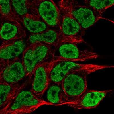 Immunocytochemistry/ Immunofluorescence NPAS1 Antibody