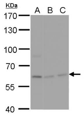 Western Blot: NPAS1 Antibody [NBP2-43651] - Analysis of A. 30 ug U87-MG whole cell lysate/extract B. 30 ug IMR32 whole cell lysate/extract C. 30 ug SK-N-AS whole cell lysate/extract 7.5 % SDS-PAGE NPAS1 antibody dilution: 1:1000