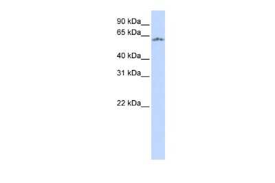 Western Blot: NPAS1 Antibody [NBP2-85396] - WB Suggested Anti-NPAS1 Antibody Titration: 0.2-1 ug/ml. ELISA Titer: 1:312500. Positive Control: Hela cell lysate