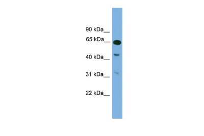 Western Blot: NPAS1 Antibody [NBP2-85397] - WB Suggested Anti-Npas1 Antibody Titration: 0.2-1 ug/ml. ELISA Titer: 1:312500. Positive Control: Mouse Brain