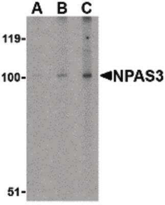 Western Blot: NPAS3 Antibody [NBP1-03198] - Western blot of NPAS3 in rat brain tissue lysate with NPAS3 antibody at (A) 0.5, (B) 1 and (C) 2 ug/ml.