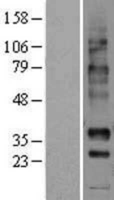 Western Blot: NPBWR1 Overexpression Lysate (Adult Normal) [NBL1-13741] Left-Empty vector transfected control cell lysate (HEK293 cell lysate); Right -Over-expression Lysate for NPBWR1.