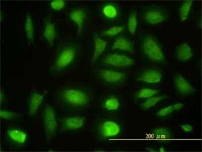Immunocytochemistry/Immunofluorescence: NPEPL1 Antibody (3F8-1A6) [H00079716-M01] - Analysis of monoclonal antibody to NPEPL1 on HeLa cell. Antibody concentration 10 ug/ml.