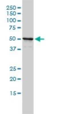 Western Blot: NPEPL1 Antibody (3F8-1A6) [H00079716-M01] - NPEPL1 monoclonal antibody (M01), clone 3F8-1A6 Analysis of NPEPL1 expression in MCF-7.